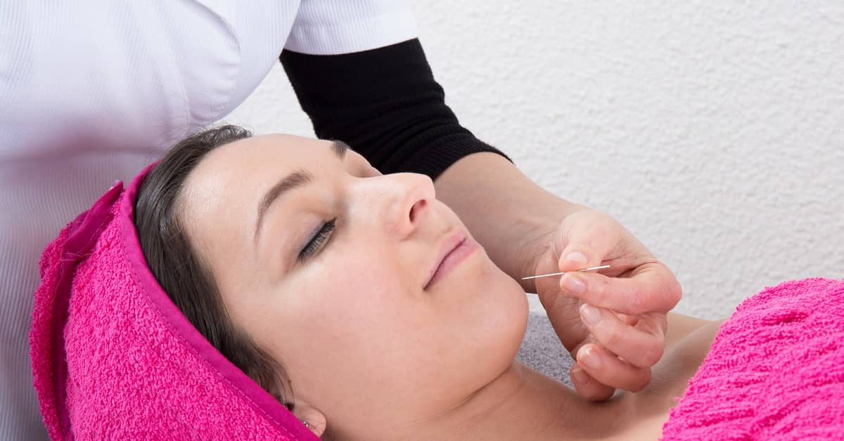 Cosmetic Acupuncture: Has Botox Met Its Match? about undefined